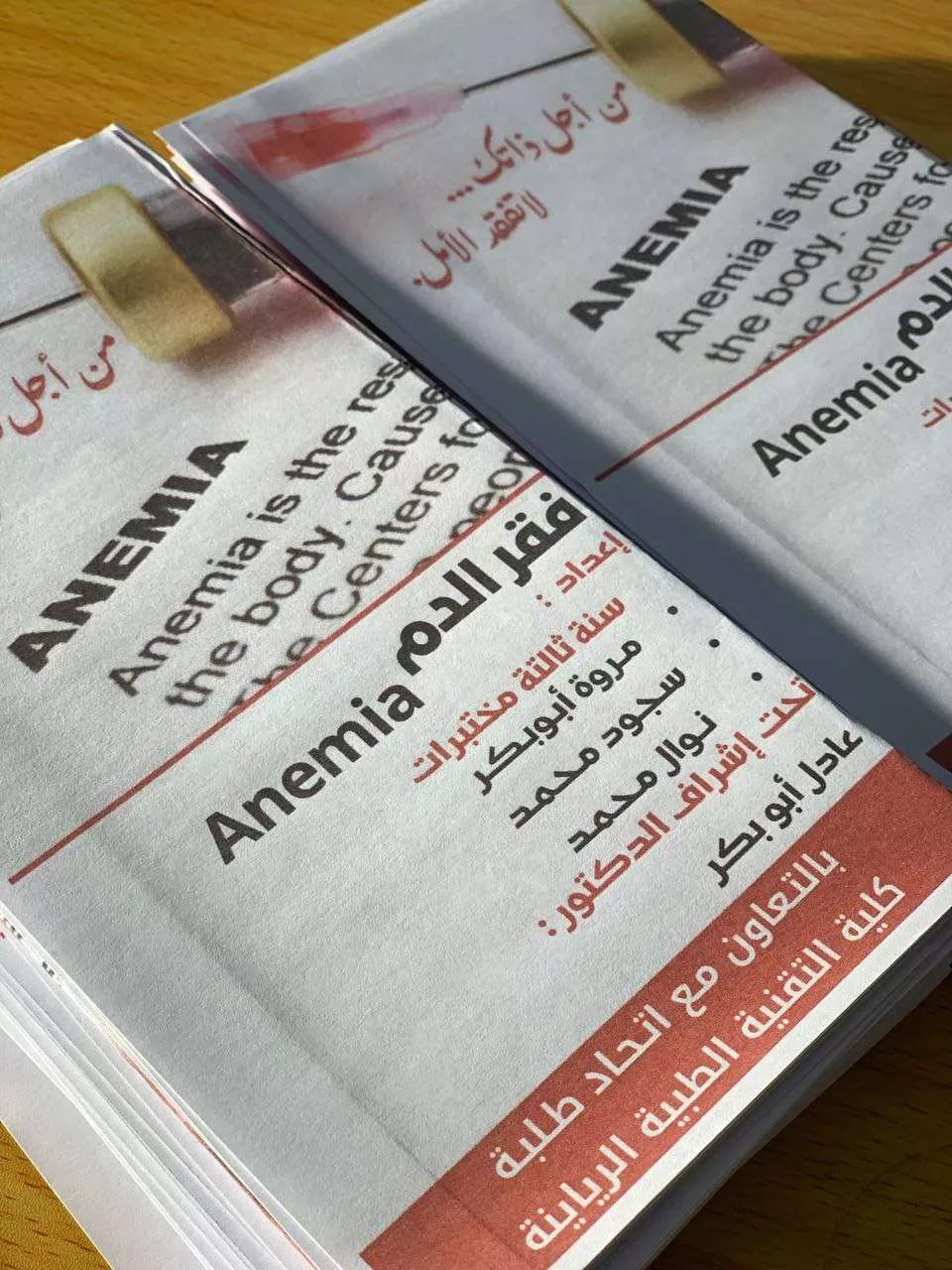 محاضرة علمية حول (فقر الدم) (Anemia)